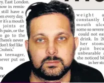  ??  ?? BRAVE Dynamo’s Crohn’s ‘moonface’