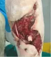  ??  ?? Previously, large hock wounds were often left open to heal, but this is a slow process