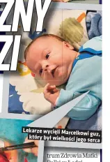  ??  ?? Lekarze wycięli Marcelkowi
g który był wielkości jego
se