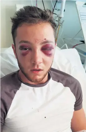  ??  ?? The Coventry University student was attacked in Primrose Hill Park while walking back from a night out in the city