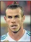  ??  ?? BALE: Injuries