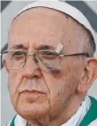  ??  ?? Pope Francis sports a shiner.