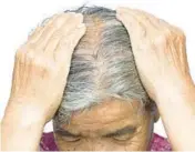  ?? DREAMSTIME ?? Menopause can bring on hair loss.
