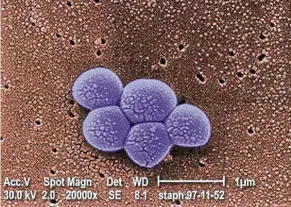  ?? — US CDC ?? A 20,000 times magnified view of MRSA from a scanning electron microscope.