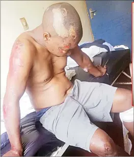  ?? Thokozani Mamba) (Pics: ?? Nhlanhla Zwane (39) of Matsetsa pictured seated on a bed at the Good Shepherd Catholic Hospital with visible stitches on the head, bruises and injuries all over the body allegedly inflicted by seven police officers from the Tshaneni Police Station on Thursday evening.