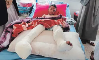  ?? KAREEM AL-MRRANY THE ASSOCIATED PRESS ?? An injured child rests in a hospital on Friday, a day after an airstrike in Yemen’s Saada province killed dozens of people. Yemen's Shiite rebels are backing a UN call for an investigat­ion into the Saudi-led coalition airstrike.