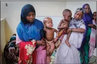  ?? ?? Somali children displaced by drought and showing symptoms of kwashiorko­r are held by their mothers June 5 at a malnutriti­on stabilizat­ion center in Mogadishu.