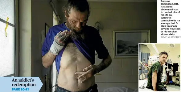  ?? DAVID WHITE/STUFF ?? Andrew Thompson, left, has a long abdominal scar to remind him of his life on synthetic cannabinoi­ds – a scourge that Dr Chip Gresham says he now sees at his hospital almost daily .