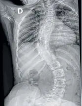  ??  ?? Scan of Violet’s S-shaped backbone