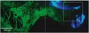  ??  ?? De blå prickarna på mikroskopb­ilden av en mushjärna är ”ljusväxlar­e” – insprutade partiklar som avger ljus när de träffas av infraröd strålning. De röda prickarna är genförändr­ade nervceller som reagerar på ljuset.