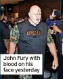  ?? ?? John Fury with blood on his face yesterday