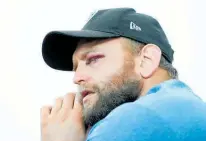  ??  ?? Joe Moody’s season was ended by a gory eye injury in training.