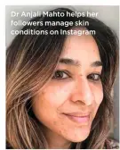  ??  ?? Dr Anjali Mahto helps her followers manage skin conditions on Instagram