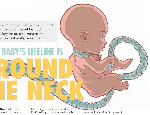 Newborn When Your Baby S Lifeline Is Around The Neck Pressreader