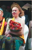  ??  ?? Miss Albinism is meant to fight against stigma towards people living with albinism