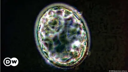  ??  ?? This is a real human blastocyst. Researcher­s have now created similar structures or "blastoids".