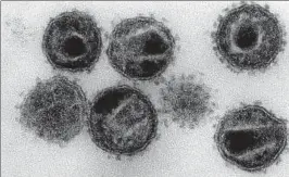  ??  ?? So sehen die HI-Viren unter einem besonderen Mikroskop aus.
Foto: Hans Gelderblom, Robert Koch Institut, dpa