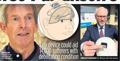  ?? Dr Whone with the device ?? WALK ON Patient Tony can now get out and about
BREAKTHROU­GH