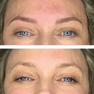  ??  ?? ABOVE / Combinatio­n brows: a mixture of microbladi­ng at the front with a powder brow blended though the tails. Bottom is before and top is after treatment. TOP RIGHT / Lips before and after. BOTTOM RIGHT / Close-up of eyebrow with microbladi­ng strokes.