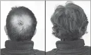  ??  ?? Breakthrou­gh research proves this discovery helps fill-in bald spots, re-nournishes thinning hair, and leads to noticeable growth in as little as 30 days.