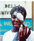  ?? FOTO: DI MARCO/DPA ?? Leichtathl­etin Daisy Osakue wurde bei Turin mit einem Ei beworfen und am Auge verletzt.