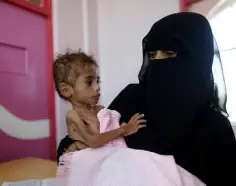  ??  ?? VICTIMS: A woman holds her son at a malnutriti­on treatment centre in Sanaa, Yemen. Photo: Khaled Abdullah/Reuters