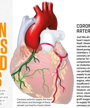  ?? ?? Coronary arteries supply the heart with blood, but blockage of these vessels can lead to a heart attack