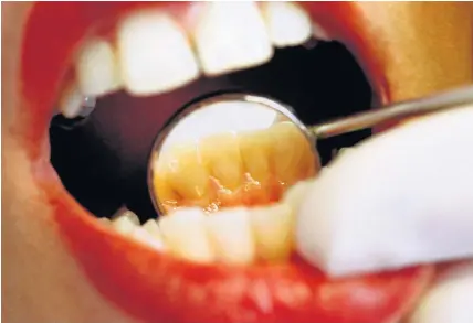  ?? Ben Edwards ?? > The Welsh Government is investing £1.3m to fund the expanded dental services