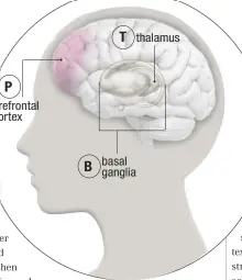  ??  ?? P prefrontal cortex B T thalamus basal ganglia