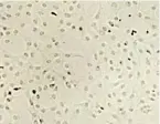 ?? BILDER: SN/UNI GRAZ/ZATLOUKAL ?? Die Zellen oben sind mit SARS-CoV2 infiziert, unten sieht man sie nach der Behandlung mit einem Spray.