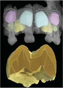  ?? CREDIT: PNAS ?? A synchrotro­n scan (above, left) of a Neandertha­l child’s maxilla highlights the permanent teeth: central incisors in light blue, lateral incisors in yellow, canines in pink and third premolars in green. The deciduous (‘baby’) teeth are grey. Cross-section slices, top right, show the extent of enamel developmen­t. The neonatal line revealed in a first molar’s dentine tip, bottom right, suggests that the tooth part began forming about 17 days before the child’s birth.