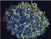  ?? NATIONAL INSTITUTE OF ALLERGY AND INFECTIOUS DISEASES ?? This colorized electron microscope image shows a human T cell, indicated in blue, under attack by HIV, in yellow, the virus that causes AIDS.
