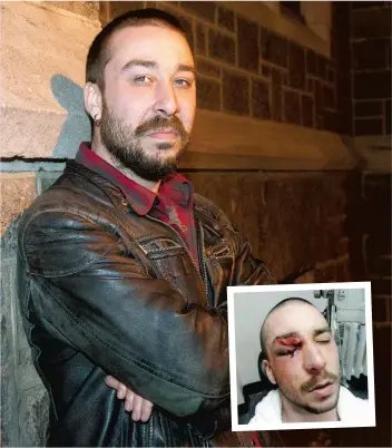  ??  ?? PHOTOS MARTIN ALARIE ET TIRÉE DE TWITTER. Francis Grenier se dit soulagé de la fin du processus judiciaire contre la Ville de Montréal et ses policiers. En mortaise, une photo de sa blessure à l’hôpital, en mars 2012.