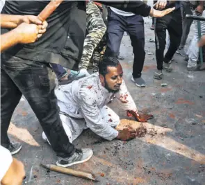  ??  ?? THE FEBRUARY 24 PHOTOGRAPH of Mohammed Zubair being beaten, which became the defining image of the violence in North East Delhi. (Right) Zubair at home with bandages on his head and legs.