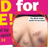  ??  ?? The ghost made marks on my chest