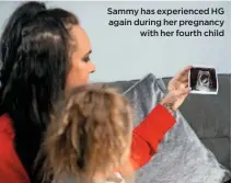  ??  ?? Sammy has experience­d HG again during her pregnancy
with her fourth child