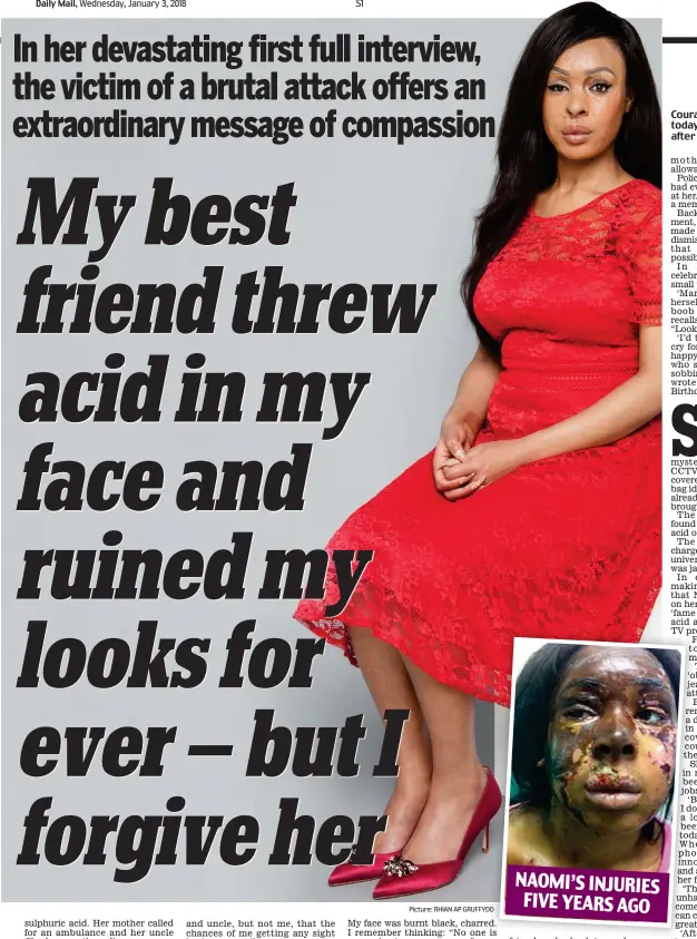  ?? Picture: RHIAN AP GRUFFYDD ?? Courageous: Naomi Oni today, aged 25, and (inset) after the acid attack NAOMI’S INJURIES FIVE YEARS AGO