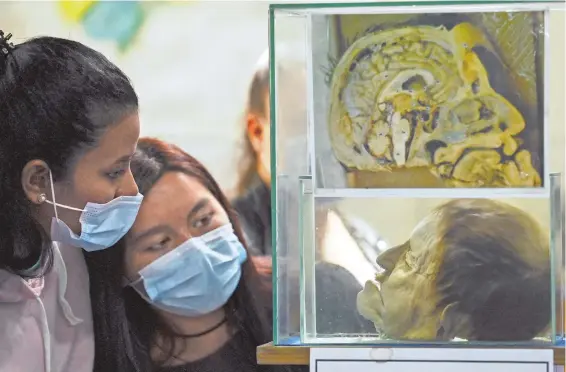  ?? FOTOS: JUAN BARRETO/AFP ?? culminante de la exhibición es un medio cráneo sumergido en formol que revela todos los detalles del cerebro de un anciano