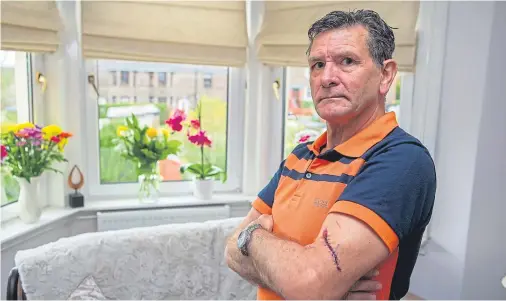  ??  ?? TRAUMATISE­D: Arthur Innes, 61, tried to block the chainsaw while wedged between two cars but was struck on the head and upper arm