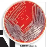  ??  ?? KILLER The bacteria
