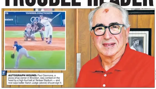  ?? ?? AUTOGRAPH HOUND: Paul Giannone, a pizza-shop owner in Brooklyn, was conked on the head by a high foul ball at Yankee Stadium — and now says batter Aaron Judge (above) should sign it.