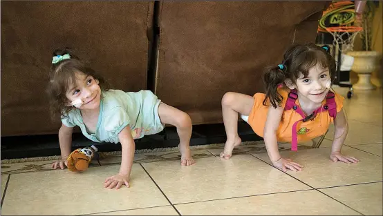  ?? Sacramento Bee/TNS/LEZLIE STERLING ?? Formerly conjoined twins, Erika (left) and Eva Sandoval, push their bodies up in an attempt to stand up and show off for their mother while playing in the living room.