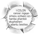  ??  ?? I-COLON cancer ingeyesihl­anu ezifweni ezihamba phambili ekuphathen­i abantu besilisa.