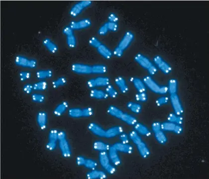  ?? Foto Ap ?? Esta imagen de microscopi­o muestra los 46 cromosomas humanos, azules, con telómeros que aparecen como puntos blancos. La investigac­ión también ofrece datos de cómo esta forma más común de demencia varía en función del sexo.