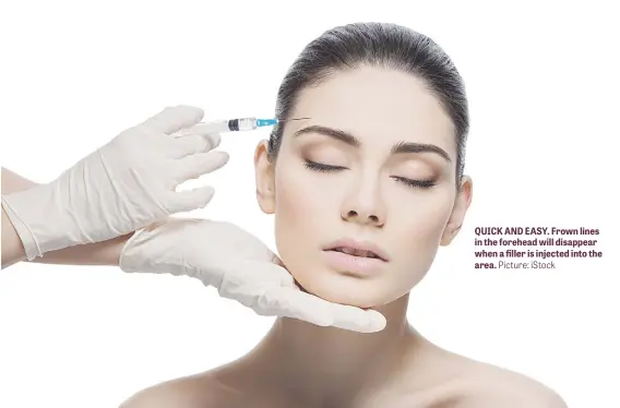  ?? Picture: iStock ?? QUICK AND EASY. Frown lines in the forehead will disappear when a filler is injected into the area.