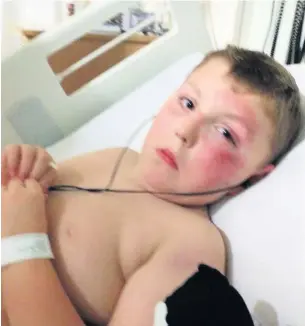 ?? Oliver Edwards-Kiernan, seven in hospital after he was knocked over by a scrambler bike in Skelmersda­le ??