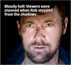  ??  ?? Bloody hell: Viewers were stunned when Rob stepped from the shadows