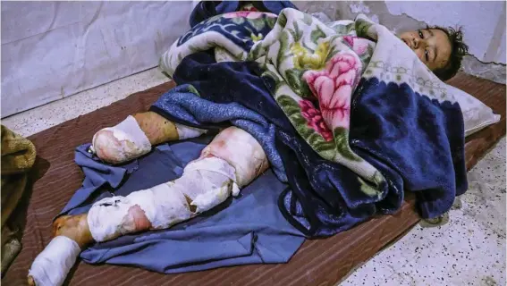  ?? PHOTO: MOHAMMED BADRA ?? YOUNG VICTIM: Yazan, an injured boy inside a hospital after he lost his leg after bombs fell on rebel-held Douma, Eastern Ghouta, on Saturday. Reports state that at least 500 people have been killed since last Sunday in Eastern Ghouta from bombings and...