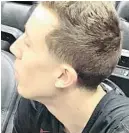  ?? IRA WINDERMAN/SUN SENTINEL ?? It not a hickey, Heat forward Duncan Robinson explains.