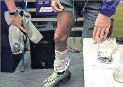  ??  ?? CICATRIZ. Rossi muestra la pierna de la que fue operado.